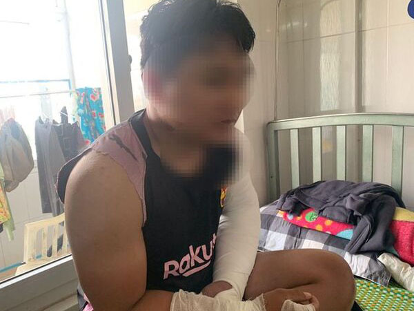 Shipper bị đánh gãy hai tay ở Quảng Ngãi: "Hành vi côn đồ, có thể khởi tố vụ án hình sự"